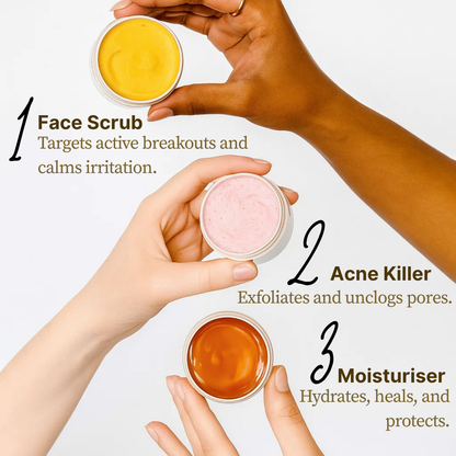 3-in-1 Acne & Redness Rescue Kit