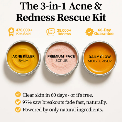 3-in-1 Acne & Redness Rescue Kit