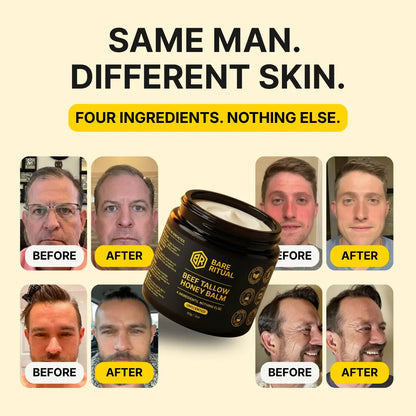 Beef Tallow Honey Balm™