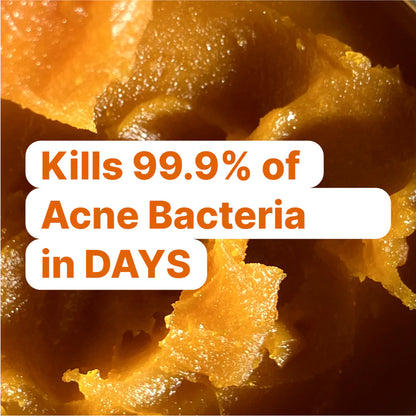 Acne Killer Balm